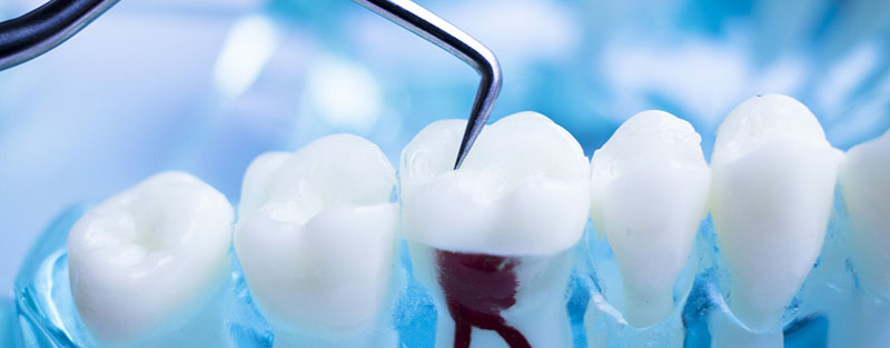 مراقبت از دندان بهترین روش ممکن برای زیبایی دندان