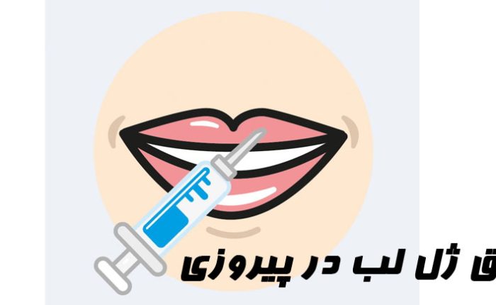 تزریق ژل لب در پیروزی